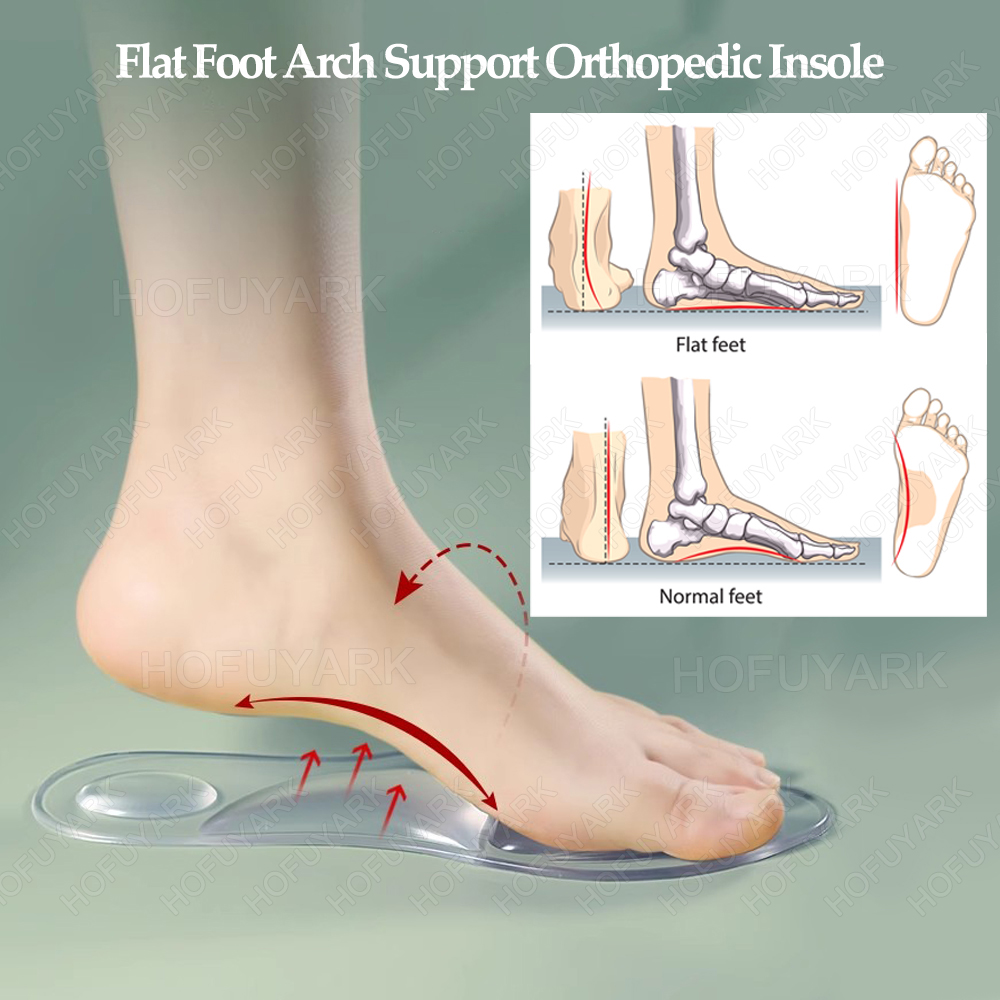 Silicone Gel Insoles Orthopedi - đánh giá và giá Women'S Shoes High Arch Support